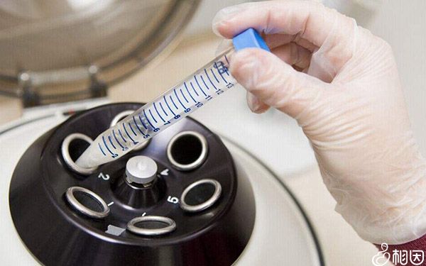 女性雌激素过高能不能男人试管代怀孕？