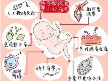 甘肃有没有可以生试管男孩的医院？