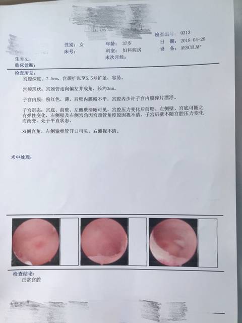 代怀试管婴儿婴儿吃什么能让子宫内膜增厚