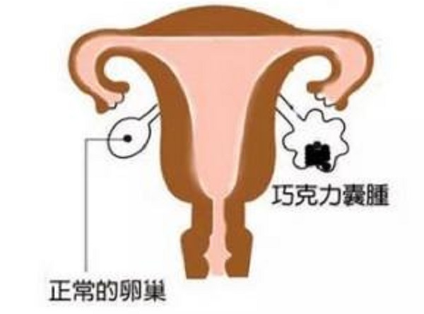 怎样提高试管捐卵代怀机构成功率短租