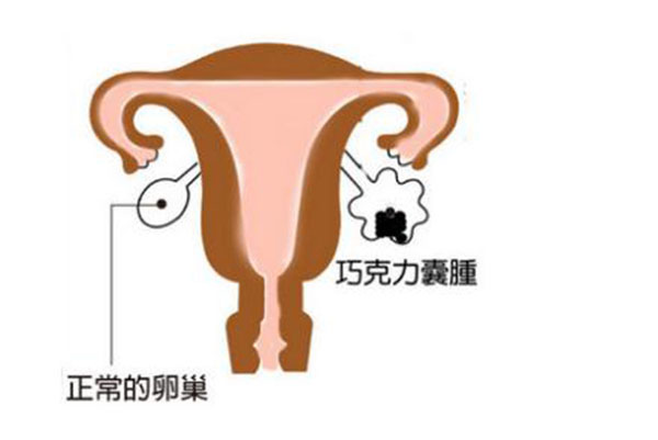 供卵试管公司电话手术需要多少钱
