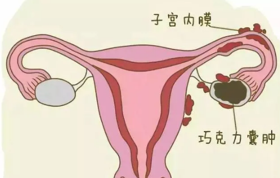 单身供捐精卵试管新闻+一个单身女人决定第三代试管生男孩价格